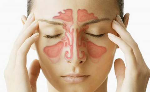WHAT ARE THE FACTORS FACILITATING THE FORMATION OF SINUSITIS?